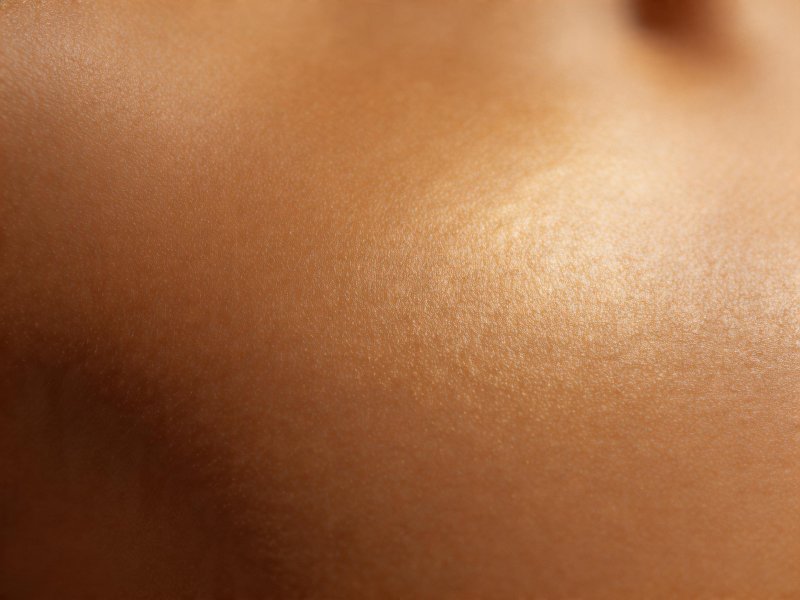 Epilarea laser pe piele bronzată sau închisă la culoare - Ghid de Siguranță
